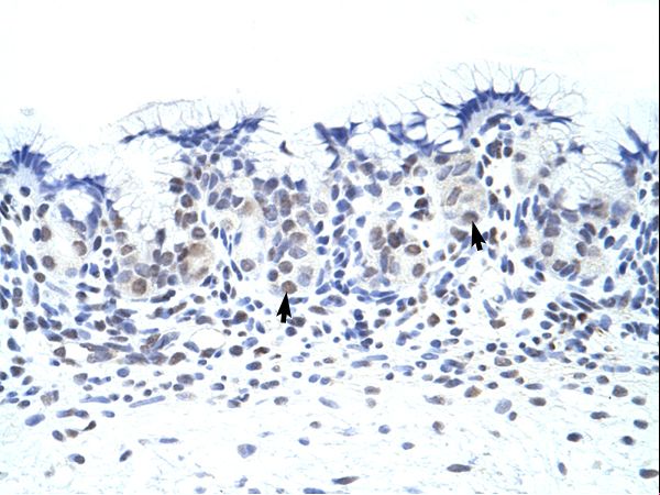 ZNF70 Antibody - ZNF70 antibody ARP39515_T100-NP_068735-ZNF70 (zinc finger protein 70) Antibody was used in IHC to stain formalin-fixed, paraffin-embedded human stomach.  This image was taken for the unconjugated form of this product. Other forms have not been tested.