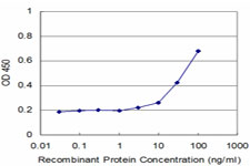 ZNF70 Antibody - Detection limit for recombinant GST tagged ZNF70 is approximately 3 ng/ml as a capture antibody.