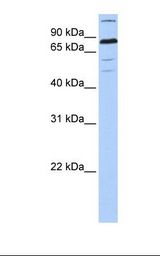 ZNF700 Antibody - 721_B cell lysate. Antibody concentration: 1.0 ug/ml. Gel concentration: 12%.  This image was taken for the unconjugated form of this product. Other forms have not been tested.