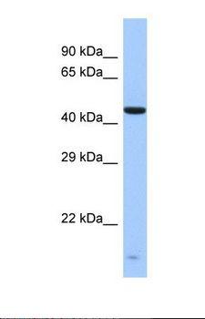 ZNF701 Antibody - Western blot of Human Fetal Liver. ZNF701 antibody dilution 1.0 ug/ml.  This image was taken for the unconjugated form of this product. Other forms have not been tested.