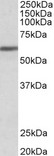 ZNF703 Antibody - Goat Anti-ZNF703 Antibody (1µg/ml) staining of Human Breast cancer lysate (35µg protein in RIPA buffer). Primary incubation was 1 hour. Detected by chemiluminescencence.