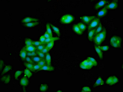 ZNF703 Antibody - Immunofluorescence staining of HepG2 cells at a dilution of 1:133, counter-stained with DAPI. The cells were fixed in 4% formaldehyde, permeabilized using 0.2% Triton X-100 and blocked in 10% normal Goat Serum. The cells were then incubated with the antibody overnight at 4 °C.The secondary antibody was Alexa Fluor 488-congugated AffiniPure Goat Anti-Rabbit IgG (H+L) .