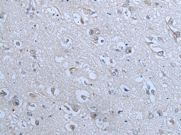 ZNF703 Antibody - Immunohistochemistry of paraffin-embedded Human brain tissue  using ZNF703 Polyclonal Antibody at dilution of 1:55(×200)