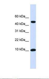 ZNF706 Antibody - Transfected 293T cell lysate. Antibody concentration: 1.0 ug/ml. Gel concentration: 10-20%.  This image was taken for the unconjugated form of this product. Other forms have not been tested.