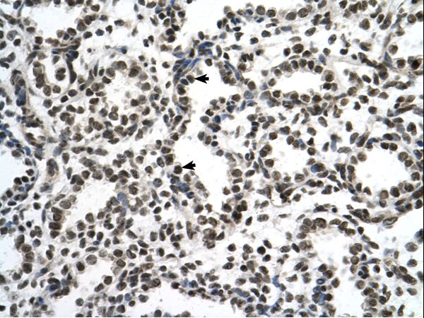 ZNF706 Antibody - ZNF706 antibody ZNF706(zinc finger protein 706) Antibody was used in IHC to stain formalin-fixed, paraffin-embedded human lung.  This image was taken for the unconjugated form of this product. Other forms have not been tested.