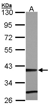 ZNF707 Antibody - Sample (30 ug of whole cell lysate). A: Hep G2 . 10% SDS PAGE. ZNF707 antibody diluted at 1:5000.