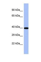 ZNF707 Antibody - Western blot of Human HT1080 Whole cell . ZNF707 antibody dilution 1.0 ug/ml.  This image was taken for the unconjugated form of this product. Other forms have not been tested.