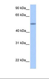 ZNF708 Antibody - Fetal liver lysate. Antibody concentration: 1.0 ug/ml. Gel concentration: 12%.  This image was taken for the unconjugated form of this product. Other forms have not been tested.