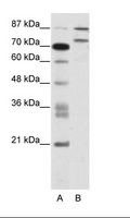 ZNF709 Antibody - A: Marker, B: Jurkat Cell Lysate.  This image was taken for the unconjugated form of this product. Other forms have not been tested.