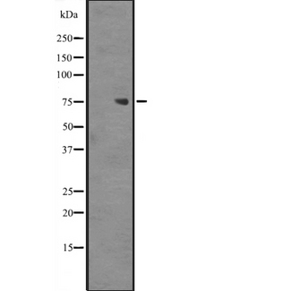 ZNF709 Antibody - Western blot analysis of ZNF709 expression in Jurkat cells lysate. The lane on the left is treated with the antigen-specific peptide.