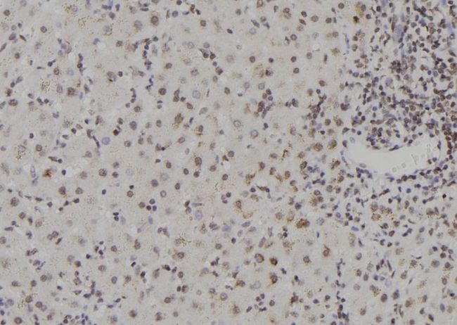 ZNF709 Antibody - 1:100 staining human liver tissue by IHC-P. The sample was formaldehyde fixed and a heat mediated antigen retrieval step in citrate buffer was performed. The sample was then blocked and incubated with the antibody for 1.5 hours at 22°C. An HRP conjugated goat anti-rabbit antibody was used as the secondary.