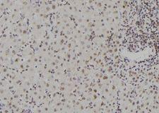 ZNF709 Antibody - 1:100 staining human liver tissue by IHC-P. The sample was formaldehyde fixed and a heat mediated antigen retrieval step in citrate buffer was performed. The sample was then blocked and incubated with the antibody for 1.5 hours at 22°C. An HRP conjugated goat anti-rabbit antibody was used as the secondary.