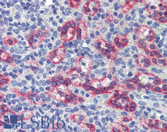 ZNF71 Antibody - Anti-ZNF71 antibody IHC of human spleen. Immunohistochemistry of formalin-fixed, paraffin-embedded tissue after heat-induced antigen retrieval. Antibody concentration 5 ug/ml.  This image was taken for the unconjugated form of this product. Other forms have not been tested.