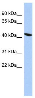 ZNF71 Antibody - Western analysis of PANC1 cell lysate.  This image was taken for the unconjugated form of this product. Other forms have not been tested.