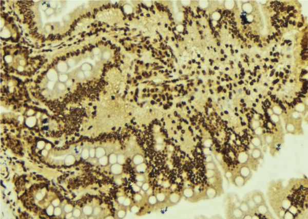 ZNF71 Antibody - 1:100 staining mouse colon tissue by IHC-P. The sample was formaldehyde fixed and a heat mediated antigen retrieval step in citrate buffer was performed. The sample was then blocked and incubated with the antibody for 1.5 hours at 22°C. An HRP conjugated goat anti-rabbit antibody was used as the secondary.