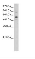ZNF71 Antibody - Jurkat Cell Lysate.  This image was taken for the unconjugated form of this product. Other forms have not been tested.