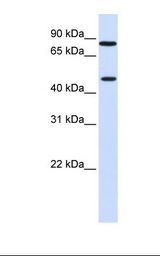 ZNF710 Antibody - Fetal muscle lysate. Antibody concentration: 1.0 ug/ml. Gel concentration: 12%.  This image was taken for the unconjugated form of this product. Other forms have not been tested.