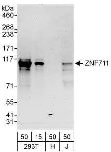 ZNF711 Antibody - Detection of Human ZNF711 by Western Blot. Samples: Whole cell lysate from 293T (15 and 50 ug), HeLa (H; 50 ug) and Jurkat (J; 50 ug) cells. Antibodies: Affinity purified rabbit anti-ZNF711 antibody used for WB at 0.1 ug/ml. Detection: Chemiluminescence with an exposure time of 3 minutes.