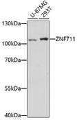 ZNF711 Antibody - Western blot analysis of extracts of various cell lines using ZNF711 Polyclonal Antibody at dilution of 1:1000.