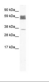 ZNF713 Antibody - Fetal Spleen Lysate.  This image was taken for the unconjugated form of this product. Other forms have not been tested.