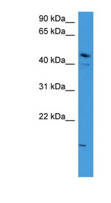 ZNF713 Antibody - ZNF713 antibody Western blot of OVCAR-3 cell lysate. This image was taken for the unconjugated form of this product. Other forms have not been tested.