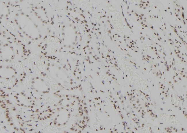 ZNF713 Antibody - 1:100 staining human kidney tissue by IHC-P. The sample was formaldehyde fixed and a heat mediated antigen retrieval step in citrate buffer was performed. The sample was then blocked and incubated with the antibody for 1.5 hours at 22°C. An HRP conjugated goat anti-rabbit antibody was used as the secondary.