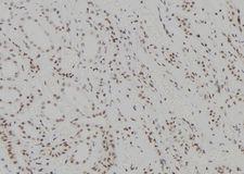 ZNF713 Antibody - 1:100 staining human kidney tissue by IHC-P. The sample was formaldehyde fixed and a heat mediated antigen retrieval step in citrate buffer was performed. The sample was then blocked and incubated with the antibody for 1.5 hours at 22°C. An HRP conjugated goat anti-rabbit antibody was used as the secondary.