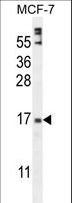 ZNF720 Antibody - ZNF720 Antibody western blot of MCF-7 cell line lysates (35 ug/lane). The ZNF720 antibody detected the ZNF720 protein (arrow).