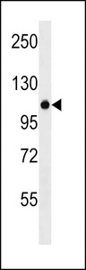 ZNF729 Antibody - ZNF729 Antibody western blot of A375 cell line lysates (35 ug/lane). The ZNF729 antibody detected the ZNF729 protein (arrow).