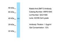 ZNF73 Antibody -  This image was taken for the unconjugated form of this product. Other forms have not been tested.