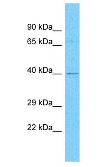 ZNF735 Antibody - ZNF735 antibody Western Blot of 721_B. Antibody dilution: 1 ug/ml.  This image was taken for the unconjugated form of this product. Other forms have not been tested.
