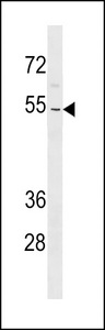 ZNF736 Antibody - ZNF736 Antibody western blot of K562 cell line lysates (35 ug/lane). The ZNF736 antibody detected the ZNF736 protein (arrow).