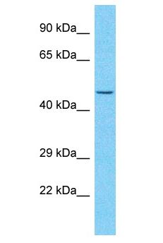 ZNF736 Antibody - ZNF736 antibody Western Blot of Jurkat. Antibody dilution: 1 ug/ml.  This image was taken for the unconjugated form of this product. Other forms have not been tested.