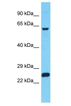 ZNF737 Antibody - ZNF737 antibody Western Blot of 721_B. Antibody dilution: 1 ug/ml.  This image was taken for the unconjugated form of this product. Other forms have not been tested.