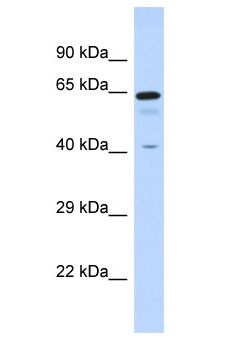 ZNF74 Antibody - ZNF74 antibody Western Blot of Fetal Liver. Antibody dilution: 1 ug/ml.  This image was taken for the unconjugated form of this product. Other forms have not been tested.