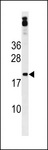 ZNF740 Antibody - ZNF740 Antibody western blot of MDA-MB453 cell line lysates (35 ug/lane). The ZNF740 antibody detected the ZNF740 protein (arrow).
