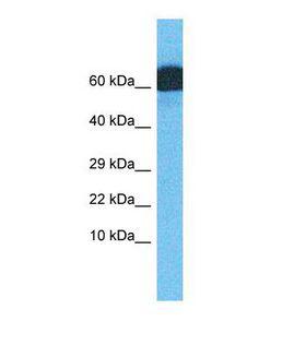 ZNF746 / PARIS Antibody - Western blot of Human Lymph Node Tumor. ZNF746 antibody dilution 1.0 ug/ml.  This image was taken for the unconjugated form of this product. Other forms have not been tested.