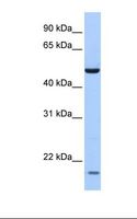 ZNF747 Antibody - Fetal lung lysate. Antibody concentration: 1.0 ug/ml. Gel concentration: 12%.  This image was taken for the unconjugated form of this product. Other forms have not been tested.