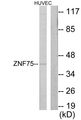ZNF75 / ZNF75D Antibody - Western blot analysis of lysates from HUVEC cells, using ZNF75 Antibody. The lane on the right is blocked with the synthesized peptide.