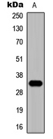 ZNF75 / ZNF75D Antibody - Western blot analysis of ZNF75D expression in HepG2 (A) whole cell lysates.