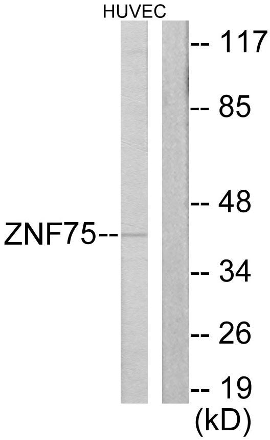 ZNF75 / ZNF75D Antibody - Western blot analysis of extracts from HUVEC cells, using ZNF75 antibody.
