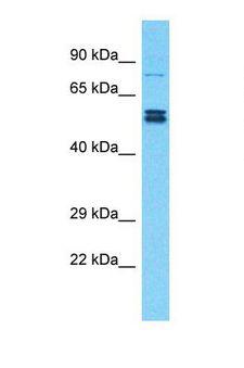 ZNF750 Antibody - Western blot of Human Lymph Node Tumor. ZNF750 antibody dilution 1.0 ug/ml.  This image was taken for the unconjugated form of this product. Other forms have not been tested.