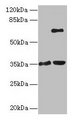 ZNF75A Antibody - Western blot All lanes: ZNF75A antibody at 10µg/ml Lane 1: Mouse brain tissue Lane 2: Mouse liver tissueSecondary Goat polyclonal to rabbit IgG at 1/10000 dilution Predicted band size: 35 kDa Observed band size: 35, 65 kDa