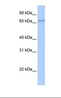 ZNF76 Antibody - Transfected 293T cell lysate. Antibody concentration: 1.0 ug/ml. Gel concentration: 12%.  This image was taken for the unconjugated form of this product. Other forms have not been tested.