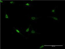 ZNF76 Antibody - Immunofluorescence of monoclonal antibody to ZNF76 on HeLa cell . [antibody concentration 10 ug/ml]