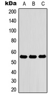 ZNF76 Antibody - Western blot analysis of ZNF76 expression in HEK293T (A); Raw264.7 (B); PC12 (C) whole cell lysates.