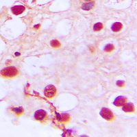 ZNF76 Antibody - Immunohistochemical analysis of ZNF76 staining in human testis formalin fixed paraffin embedded tissue section. The section was pre-treated using heat mediated antigen retrieval with sodium citrate buffer (pH 6.0). The section was then incubated with the antibody at room temperature and detected using an HRP-conjugated compact polymer system. DAB was used as the chromogen. The section was then counterstained with hematoxylin and mounted with DPX.