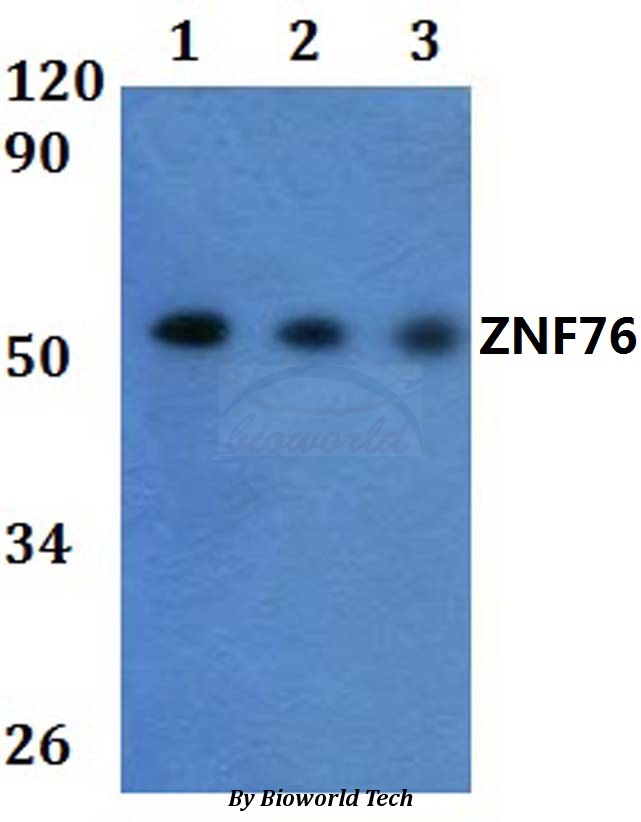 ZNF76 Antibody - Western blot of ZNF76 antibody at 1:500 dilution. Lane 1: HEK293T whole cell lysate.
