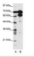 ZNF76 Antibody - A: Marker, B: HepG2 Cell Lysate.  This image was taken for the unconjugated form of this product. Other forms have not been tested.
