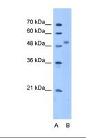 ZNF763 Antibody - Lane A: Marker. Lane B: HepG2 cell lysate. Antibody concentration: 5.0 ug/ml. Gel concentration: 12%.  This image was taken for the unconjugated form of this product. Other forms have not been tested.